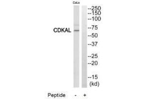 Western blot analysis of extracts from COLO205 cells, using CDKAL antibody. (CDKAL1 anticorps  (N-Term))
