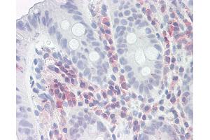 Anti-PSME1 antibody IHC of human colon.