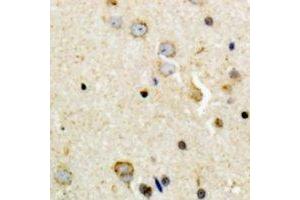 Immunohistochemical analysis of Tyrosine Hydroxylase (pS8) staining in human brain formalin fixed paraffin embedded tissue section.