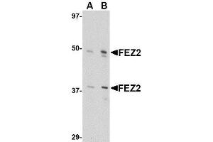 Western blot analysis of FEZ2 in 3T3 cell lysate with AP30335PU-N FEZ2 antibody at (A) 0.