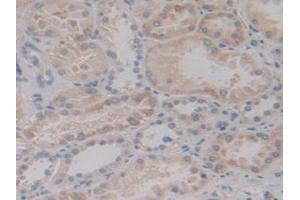 IHC-P analysis of Human Kidney Tissue, with DAB staining. (MAP2K6 anticorps  (AA 46-306))