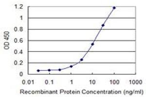 Detection limit for recombinant GST tagged ETNK1 is 0.