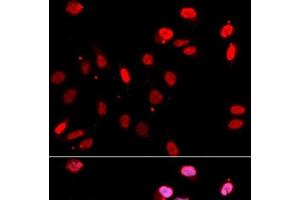 Immunofluorescence analysis of U2OS cells using RAD18 Polyclonal Antibody (RAD18 anticorps)