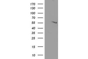 Western Blotting (WB) image for anti-Adipocyte Plasma Membrane Associated Protein (APMAP) antibody (ABIN1496663)