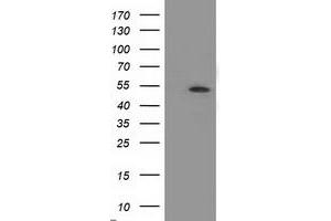 Western Blotting (WB) image for anti-Amyloid beta (A4) Precursor Protein-Binding, Family B, Member 3 (APBB3) antibody (ABIN1496653)