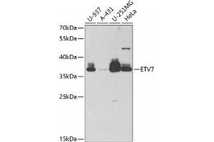 Western blot analysis of extracts of various cell lines, using ETV7 antibody (ABIN6132177, ABIN6140336, ABIN6140338 and ABIN6221858) at 1:1000 dilution. (ETV7 anticorps  (AA 1-210))