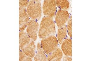 B staining GCLM in human skeletal muscle tissue sections by Immunohistochemistry (IHC-P - paraformaldehyde-fixed, paraffin-embedded sections). (GCLM anticorps  (C-Term))