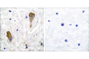 Peptide - +Immunohistochemical analysis of paraffin-embedded human brain tissue using GAD67 antibody. (GAD anticorps)
