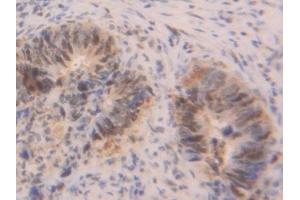 anti-Proliferating Cell Nuclear Antigen (PCNA) (AA 6-261) antibody