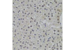 Immunohistochemistry of paraffin-embedded mouse liver using HNRNPA1 Antibody (ABIN5975570) at dilution of 1/100 (40x lens). (HNRNPA1 anticorps)