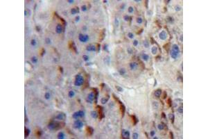 Used in DAB staining on fromalin fixed paraffin-embedded Liver tissue