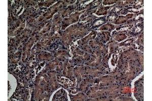 Immunohistochemistry (IHC) analysis of paraffin-embedded Human Kidney, antibody was diluted at 1:100.