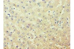 Immunohistochemistry of paraffin-embedded human liver tissue using ABIN7143588 at dilution of 1:100 (AKR7A3 anticorps  (AA 1-331))