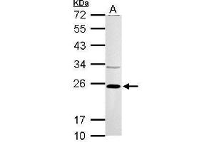 WB Image VHL antibody detects VHL protein by Western blot analysis. (VHL anticorps)