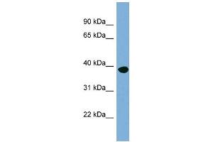 WB Suggested Anti-OAS1 Antibody Titration:  0. (OAS1 anticorps  (N-Term))