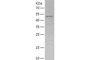 Western Blotting (WB) image for Glutamate-Cysteine Ligase, Catalytic Subunit (GCLC) (AA 1-218) protein (His-IF2DI Tag) (ABIN7123113)