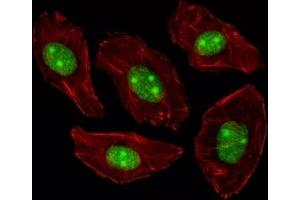 Fluorescent image of A549 cells stained with NPM1 antibody.