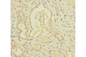 Immunohistochemistry of paraffin-embedded human kidney tissue using ABIN7159656 at dilution of 1:100 (MMACHC anticorps  (AA 63-282))