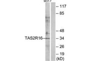 Western Blotting (WB) image for anti-Taste Receptor, Type 2, Member 16 (TAS2R16) (AA 136-185) antibody (ABIN2891092) (TAS2R16 anticorps  (AA 136-185))