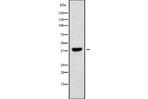 Western blot analysis of MAGAA using RAW264. (MAGEA10 anticorps  (Internal Region))