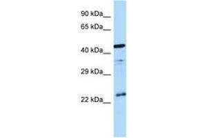 Image no. 1 for anti-Arginine Vasopressin Receptor 1B (AVPR1B) (C-Term) antibody (ABIN6747995) (AVPR1B anticorps  (C-Term))