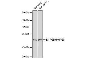 Western blot analysis of extracts of various cell lines, using 15-PGDH/HPGD Rabbit mAb (ABIN7267807) at 1:1000 dilution.