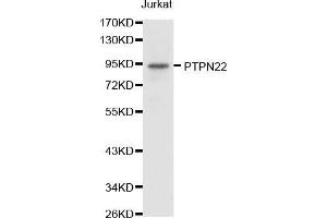 Western blot analysis of extracts of Jurkat cell lines, using PTPN22 antibody. (PTPN22 anticorps  (AA 1-90))