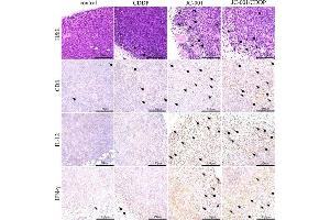 H&E and IHC staining for CD8, IL-12 and IFN-γ in subcutaneous LLC1 tumors.