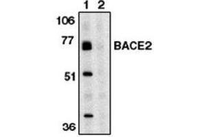 Image no. 1 for anti-beta-Site APP-Cleaving Enzyme 2 (BACE2) (AA 496-511) antibody (ABIN264997) (BACE2 anticorps  (AA 496-511))