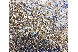 IHC-P: Bid antibody testing of rat spleen tissue (BID anticorps  (C-Term))