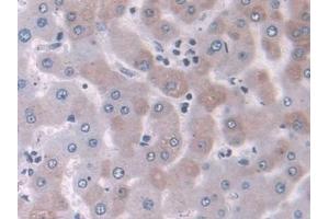 Detection of NELL2 in Human Liver Tissue using Polyclonal Antibody to NEL Like Protein 2 (NELL2)