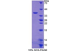 SDS-PAGE analysis of Mouse RELA Protein. (NF-kB p65 Protéine)