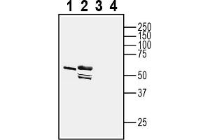 1-2. (Adiponectin Receptor 1 anticorps  (Intracellular, N-Term))