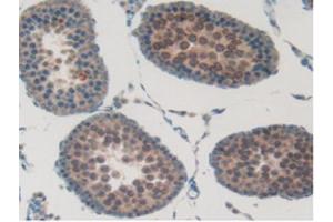 IHC-P analysis of Rat Testis Tissue, with DAB staining. (SFTPB anticorps  (AA 111-329))