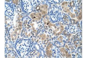 Immunohistochemistry (IHC) image for anti-Cystathionine-beta-Synthase (CBS) (N-Term) antibody (ABIN2782348)