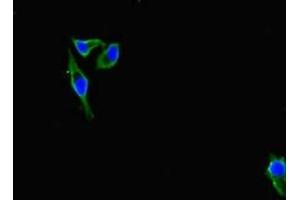 Immunofluorescent analysis of Hela cells using ABIN7156691 at dilution of 1:100 and Alexa Fluor 488-congugated AffiniPure Goat Anti-Rabbit IgG(H+L) (IFITM5 anticorps  (AA 1-36))