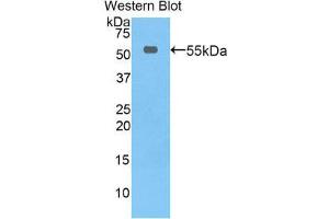 Western Blotting (WB) image for anti-Thymidine Phosphorylase (TYMP) (AA 33-290) antibody (ABIN3207502) (Thymidine Phosphorylase anticorps  (AA 33-290))