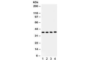 Western blot testing of 1) human placenta, 2) HeLa, 3) HUT and 4) Jurkat lysate with PINX1 antibody. (PINX1 anticorps)