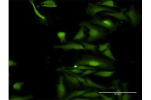 Immunofluorescence of purified MaxPab antibody to TRIM35 on HeLa cell. (TRIM35 anticorps  (AA 1-493))