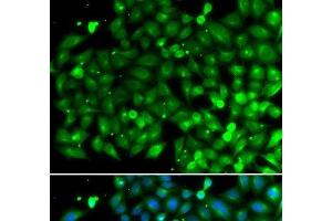 Immunofluorescence analysis of A549 cells using SH3GLB1 Polyclonal Antibody (SH3GLB1 anticorps)