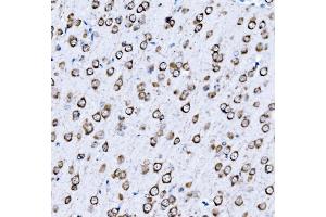 IHC analysis of VPRBP/DCAF1 using anti-VPRBP/DCAF1 antibody (ABIN7602005). (DDB1 and CUL4-Associated Factor 1 (DCAF1) (AA 540-861) anticorps)