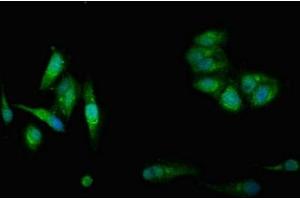 Immunofluorescent analysis of Hela cells using ABIN7148965 at dilution of 1:100 and Alexa Fluor 488-congugated AffiniPure Goat Anti-Rabbit IgG(H+L)