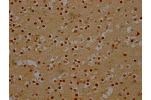 IHC image of ABIN7127452 diluted at 1:100 and staining in paraffin-embedded human brain tissue performed on a Leica BondTM system. (Recombinant DDX6 anticorps)