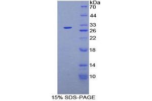 SDS-PAGE (SDS) image for Plasminogen (PLG) (AA 582-812) protein (His tag) (ABIN1099385)