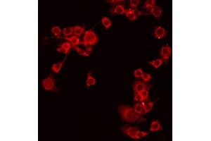 ABIN6275256 staining COLO205 by IF/ICC. (MEGF9 anticorps  (Internal Region))