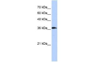 Western Blotting (WB) image for anti-ATPase, H+ Transporting, Lysosomal 38kDa, V0 Subunit D2 (ATP6V0D2) antibody (ABIN2459920) (ATP6V0D2 anticorps)