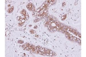 IHC-P Image Immunohistochemical analysis of paraffin-embedded SAOS-2 xenograft, using FSD2, antibody at 1:500 dilution.