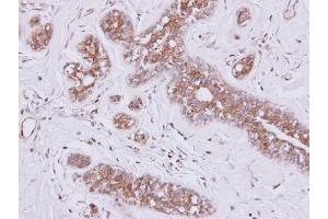 IHC-P Image Immunohistochemical analysis of paraffin-embedded SAOS-2 xenograft, using FSD2, antibody at 1:500 dilution. (FSD2 anticorps  (N-Term))