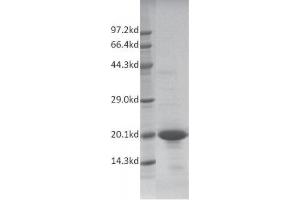 Recombinant TAF1 (1522-1656) protein gel.