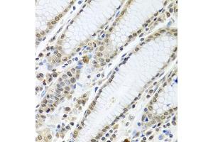 Immunohistochemistry of paraffin-embedded human stomach using TIA1 antibody. (TIA1 anticorps)